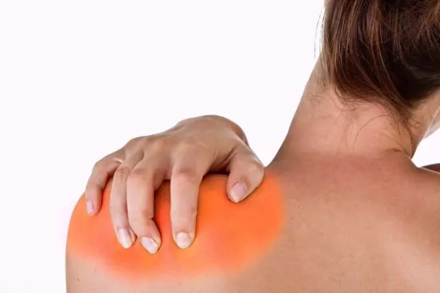 При плечевом артрозе болевые проявления могут затрагивать не только плечевой сустав пораженной руки, но и другую конечность
