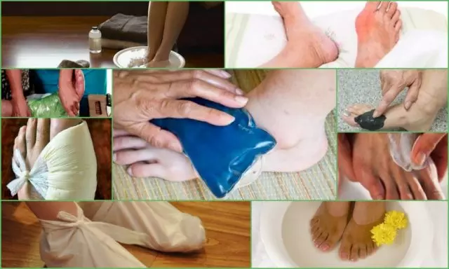 Компресс при подагре